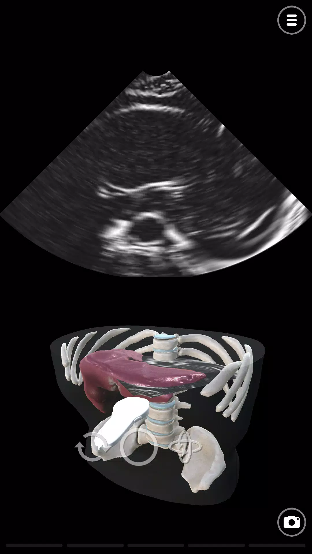 Deepscope Ultrasound Simulator 螢幕截圖 1
