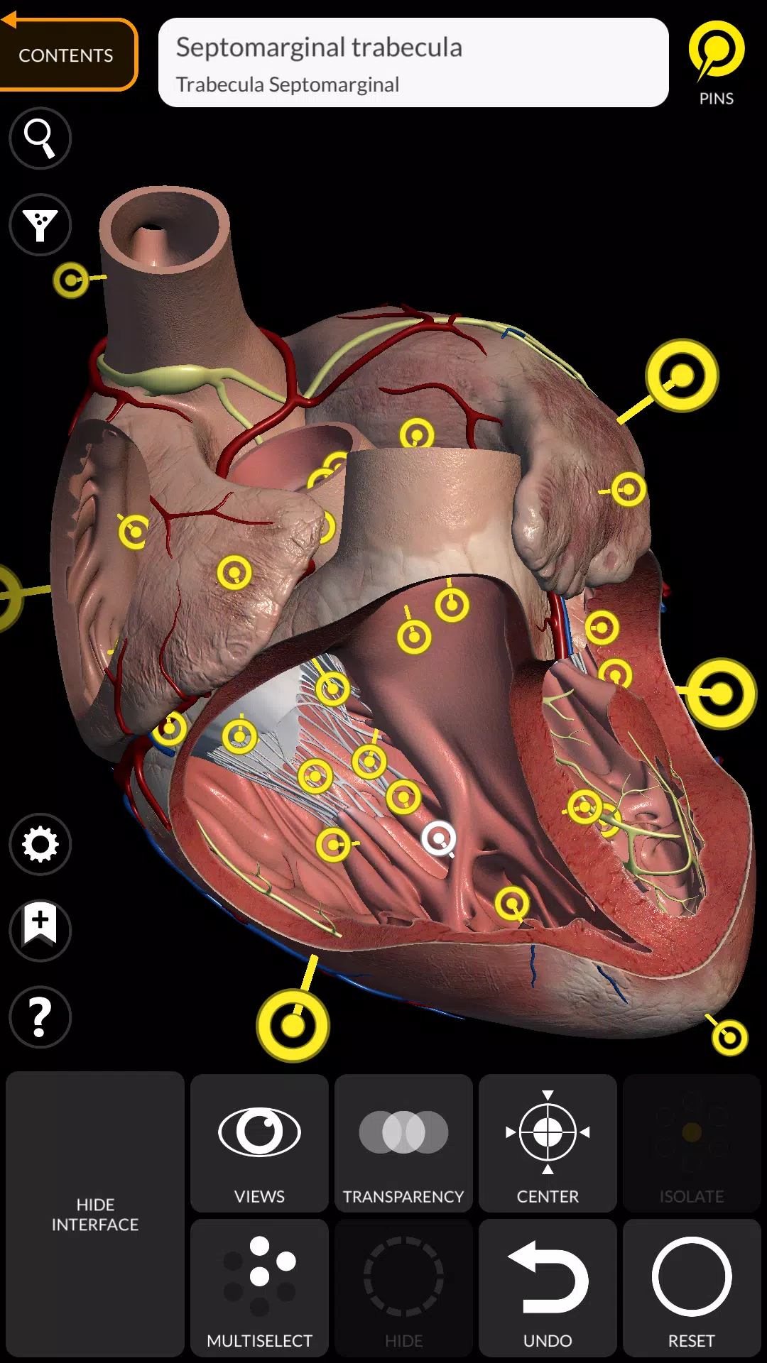Anatomy 3D Atlas Schermafbeelding 2