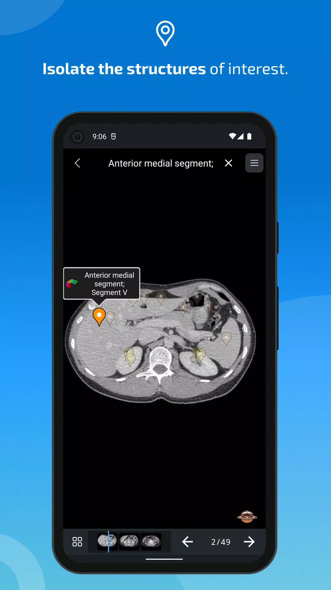 e-Anatomy Zrzut ekranu 3
