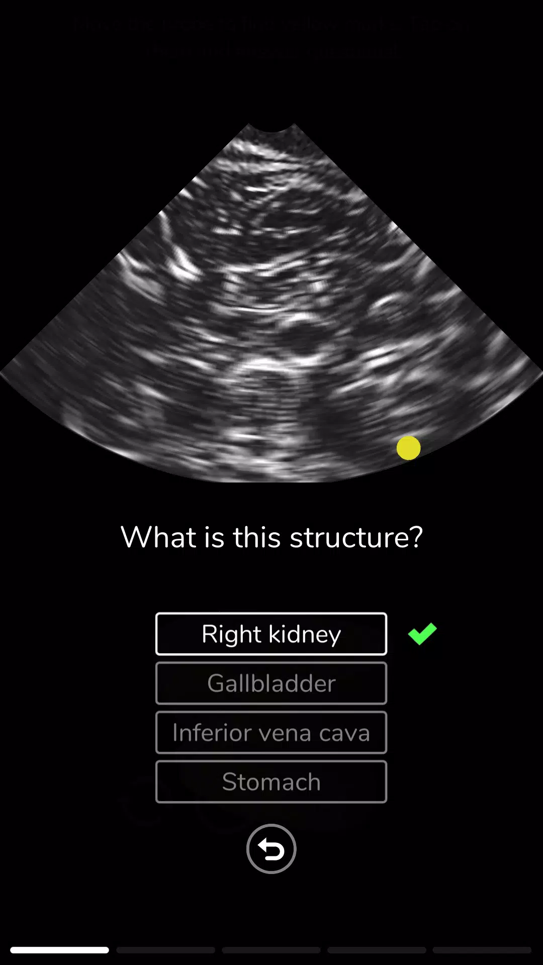 Deepscope Ultrasound Simulator 螢幕截圖 3